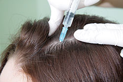 мезотерапия для волос